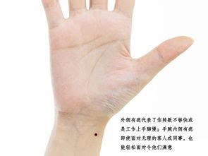 左手腕背部有痣|女人左手腕有痣全图解 女人左手腕有痣旺夫